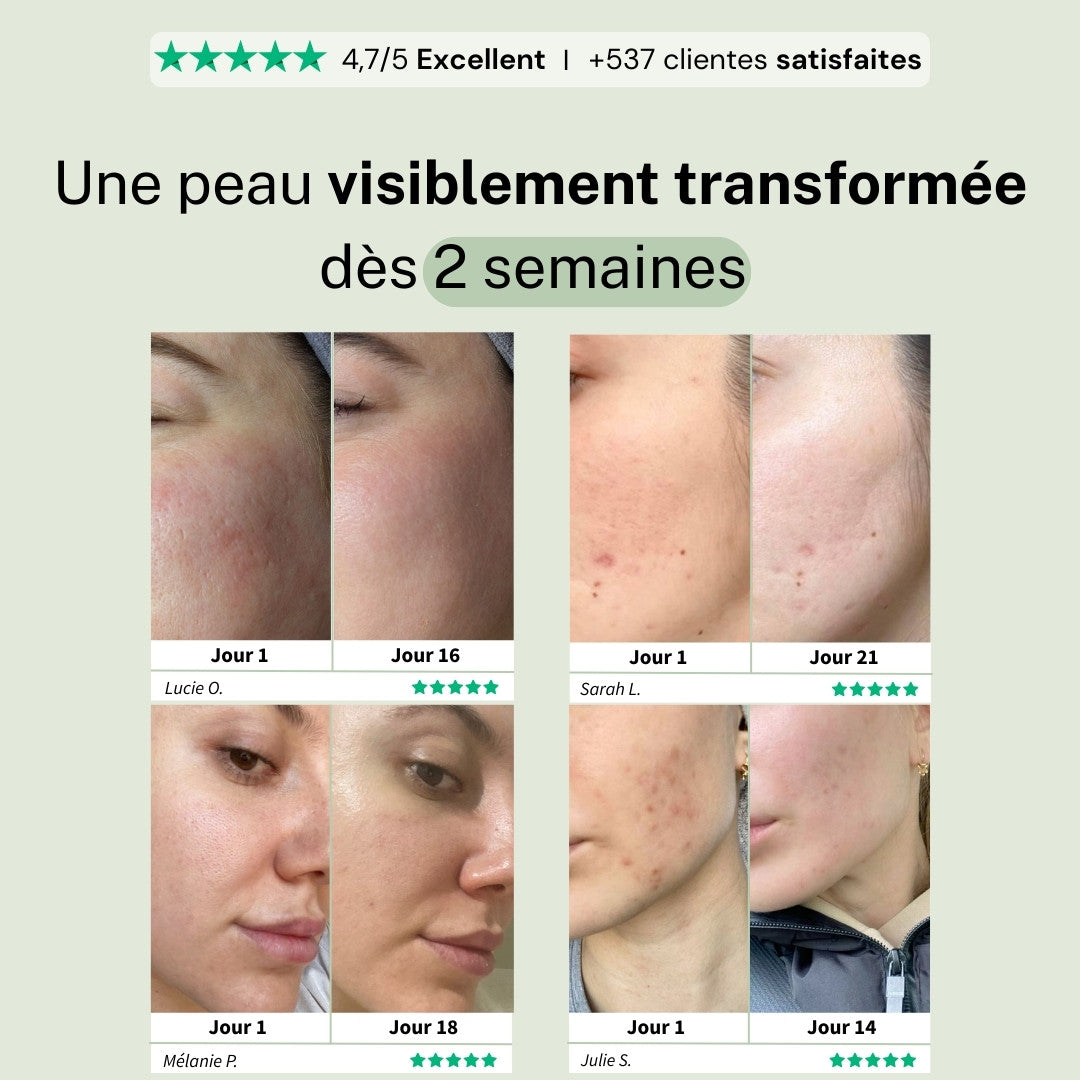 Masque purifiant au thé vert