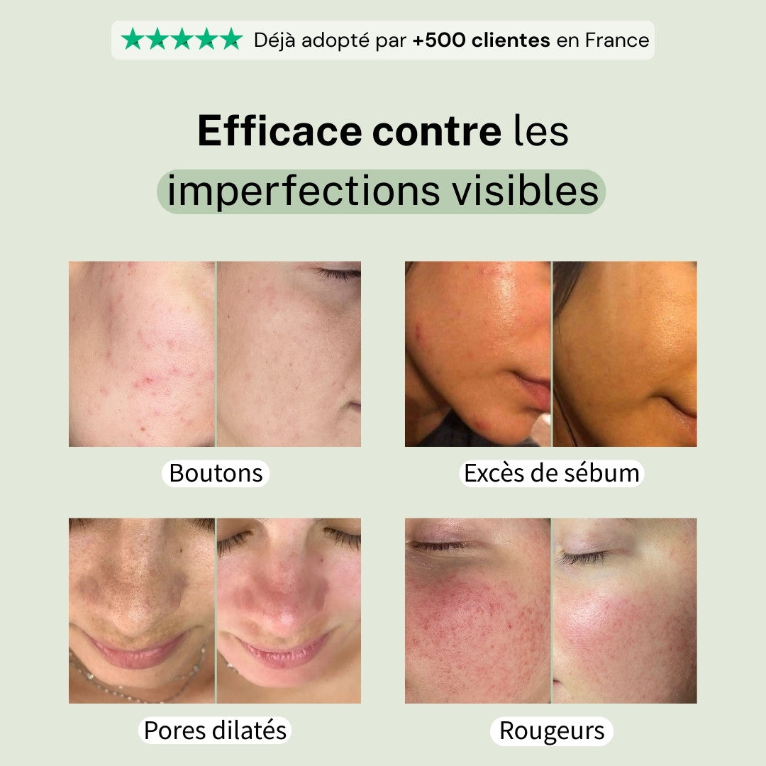 Masque purifiant au thé vert