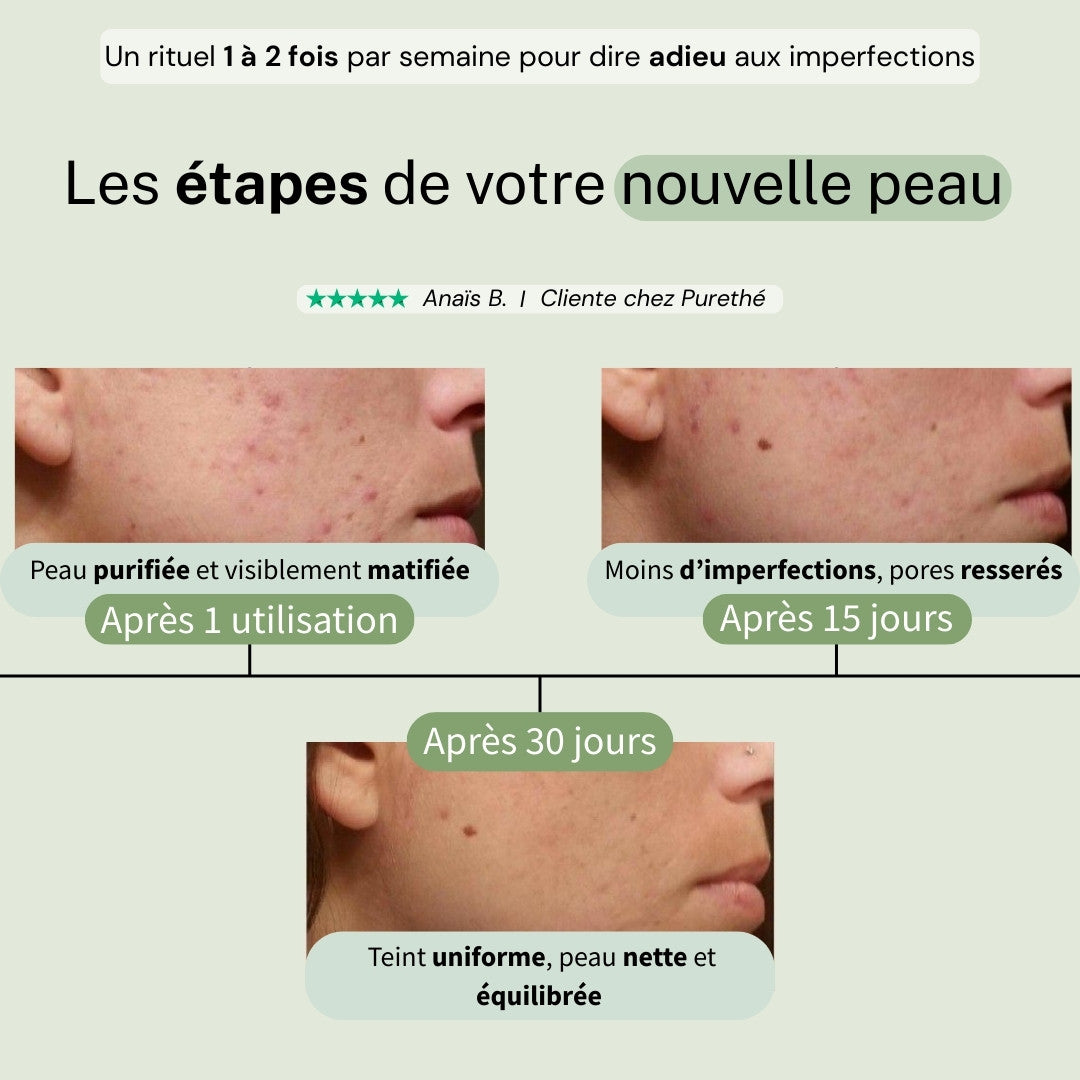 Masque purifiant au thé vert